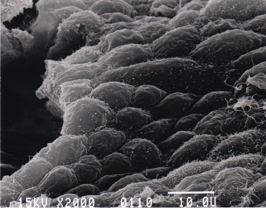 HEK-293 cells grown on Fibra-Cel disk at day 7 of the growth cycle
