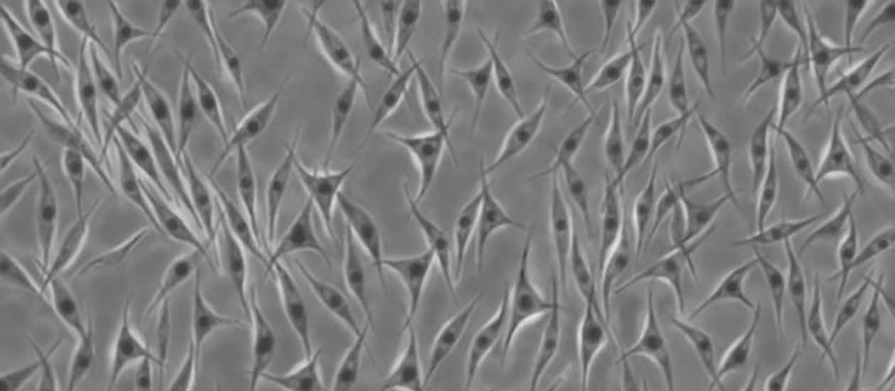 fibroblast_header_1260x550