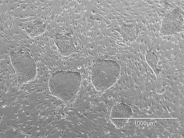 hiPSCs cultured on fibroblast-like feeder cells hiPSCs cultured on fibroblast-like feeder cells