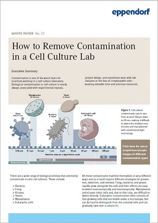 How to Remove Contamination in Cell Culture – Expand Your First Aid Kit ...
