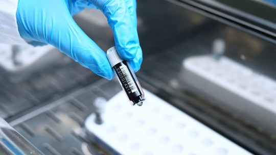 Cell thawing device – Advantages & Disadvantages - Eppendorf Southeast Asia