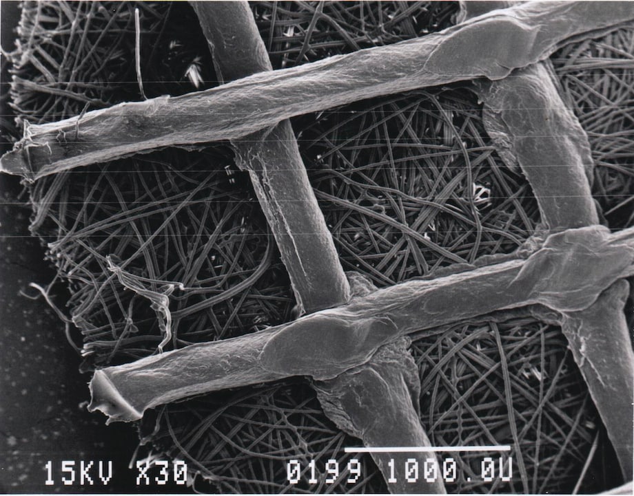 High-resolution micrograph of a Fibra‑Cel disk indicating the polyester mesh with polypropylene support High-resolution micrograph of a Fibra‑Cel disk indicating the polyester mesh with polypropylene support