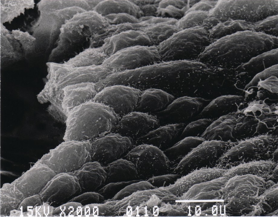 HEK-293 cells grown on Fibra-Cel disk at day 7 of the growth cycle HEK-293 cells grown on Fibra-Cel disk at day 7 of the growth cycle