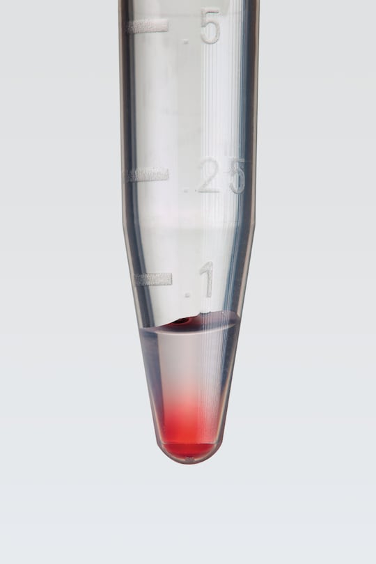 Mixing of small volumes is challenging,tubes shows suboptimal mixing of sample in microtube