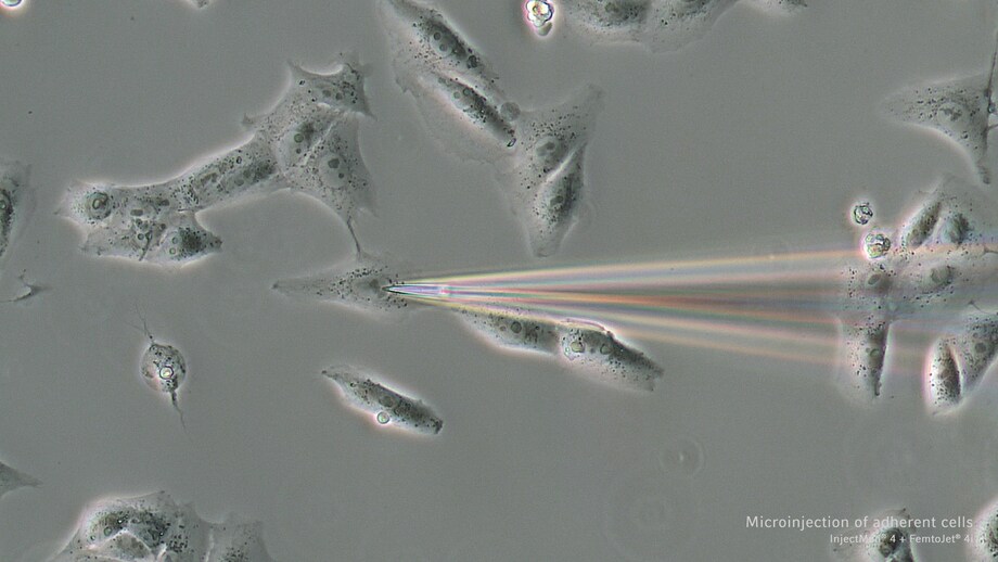 Microinjection of adherent cells Microinjection of adherent cells